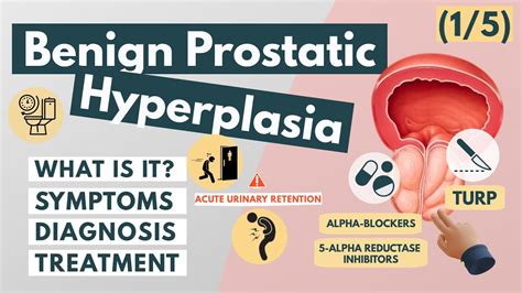 What Is Benign Prostatic Hyperplasia Overview For Med Students