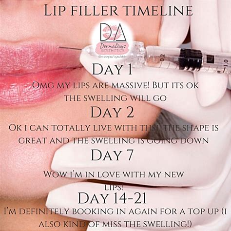 What To Expect When You Have Lip Fillers Cosmetic Fillers Facial Fillers Botox Fillers Dermal