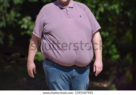 Morbidly Obese Over Royalty Free Licensable Stock Photos Shutterstock