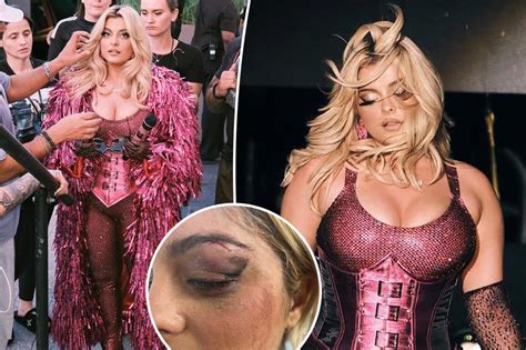 bebe rexha shares tour update after concertgoer leaves her with black eye