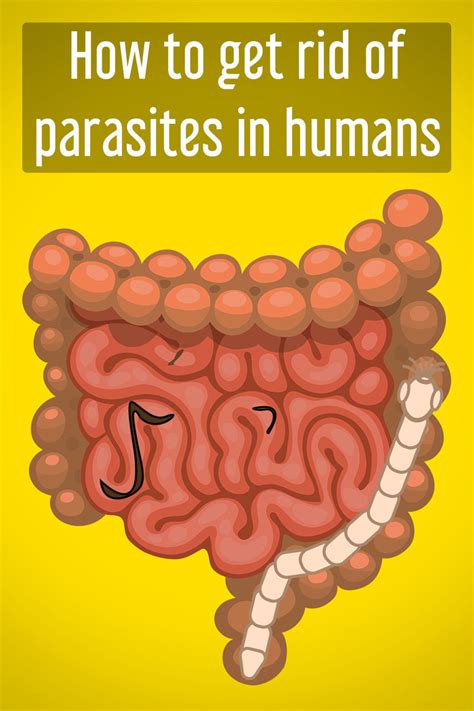 Main Symptoms Of A Parasitic Infection Abdominal Discomfort Leaky Gut Symptoms Human Experience
