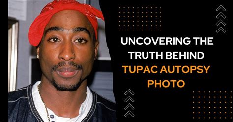 Uncovering The Truth Behind Tupac Autopsy Photo