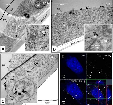 Intracellular Fate And Interaction With Cellular Organelles A Tem