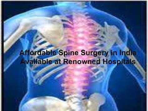 Affordable Spine Surgery In India Available At Renowned Hospitals