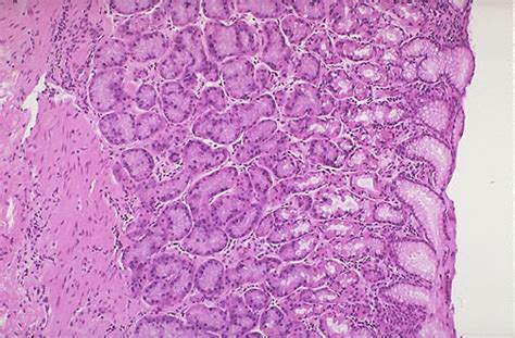 Normal Histology