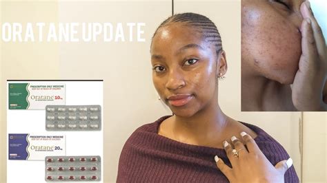 ORATANE UPDATE PLAN SIDE EFFECTS Dermatologically Approved Routine That Helped Clear My Skin