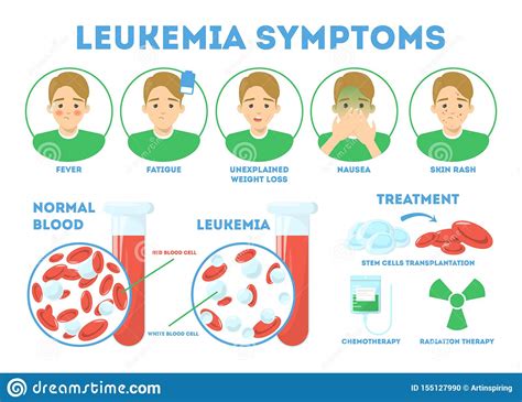Leukemia Causes Symptoms And Treatment / What Are The Symptoms And Signs Of Leukemia Ctca / The ...