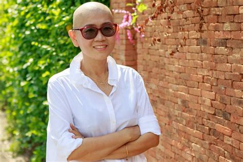 Portrait Self Confidence Asian Woman With Bald Head After Cancer Stock Image Image Of Happy
