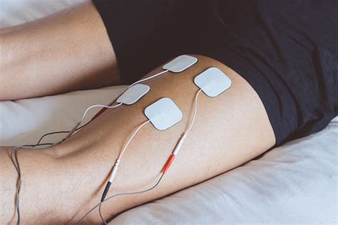 Electr Lisis Percut Nea Intratisular Una Innovadora T Cnica De Tratamiento En Fisioterapia