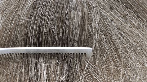 Reducing Stress Can Sometimes Reverse Grey Hair Study Finds