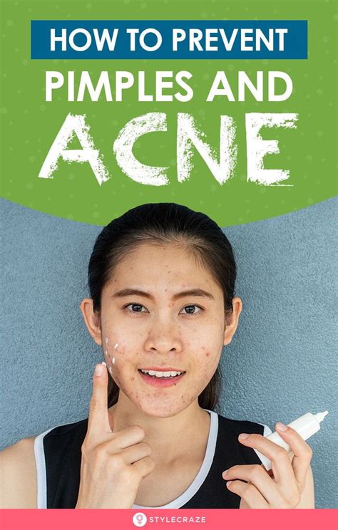 13 tips and remedies to prevent acne and pimples naturally prevent pimples acne and pimples