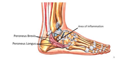 Diagram Of Foot Tendons My Xxx Hot Girl