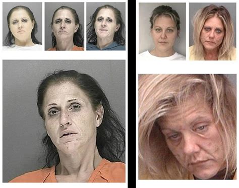 Faces Of Meth Photos Faces Of Meth Ny Daily News