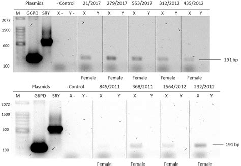 Sex Typing Of Unknown Individuals By Pcr Ethidium Bromide Stained 0 8 Download Scientific