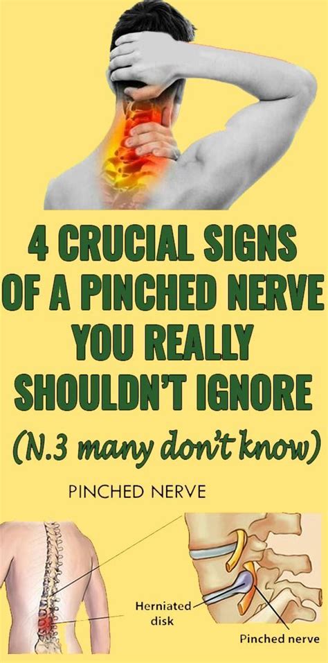 4 Crucial Signs Of A Pinched Nerve You Really Shouldt Ignore Pinched
