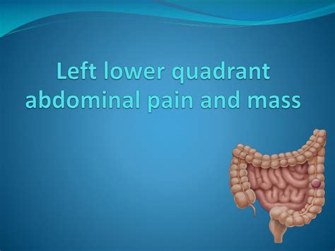 Ppt Left Lower Quadrant Abdominal Pain And Mass