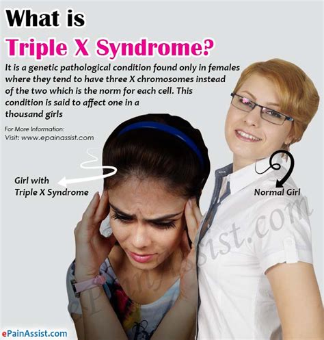 What Is Triple X Syndrome Causes Symptoms Treatment Diagnosis