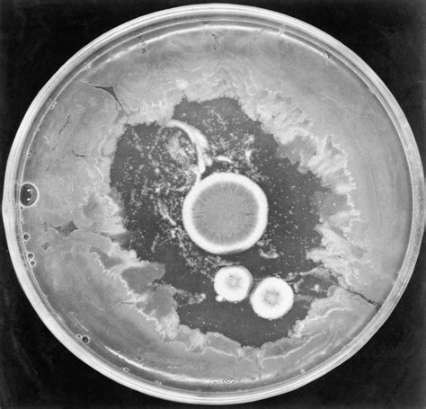 Pritzker Signs Bill Making Penicillium Rubens Official State Microbe