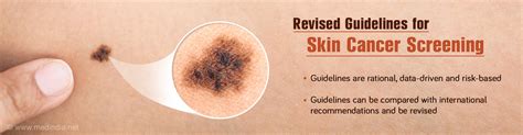 Skin Cancer Screening Data Driven Guidelines Proposed
