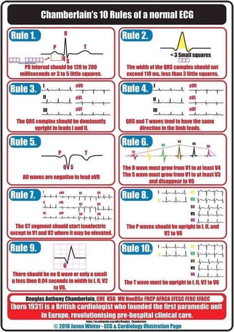 Chamberlains 10 Rules Of A Normal Ecg ~ Infographic Emergency