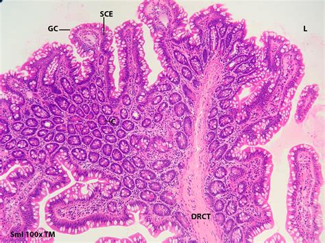 Small Intestine 10x Histology