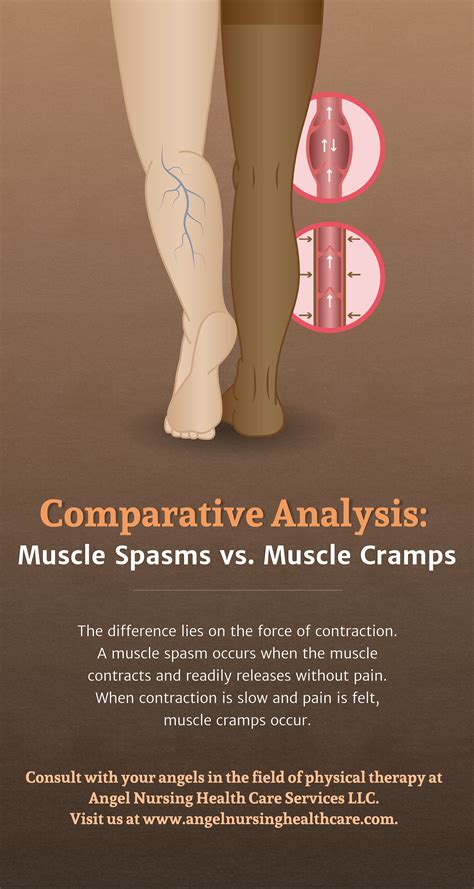 Comparative Analysis Muscle Spasms Vs Muscle Cramps Visit