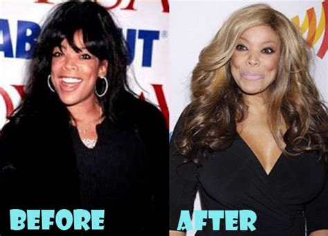 Wendy Williams Before Plastic Surgery Before And After Photosphotos