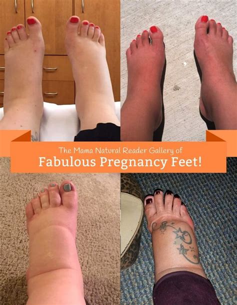 How To Reduce Feet Swelling During Pregnancy Stuffjourney