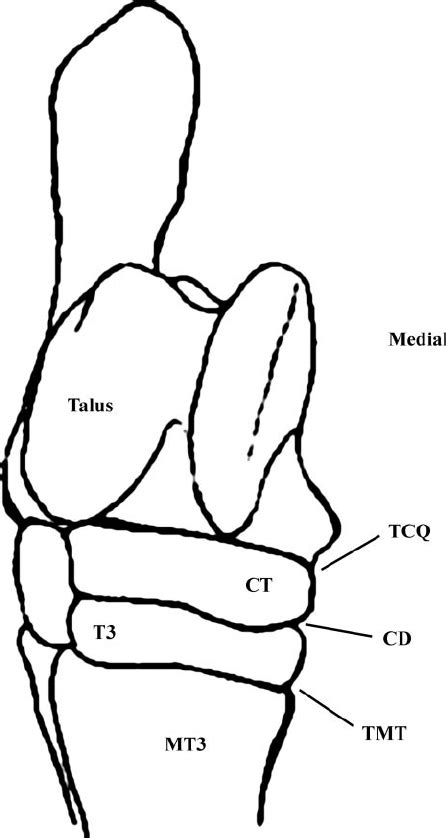 Fig 1 Diagram Of The Equine Tarsus From The Dorsal Aspect The