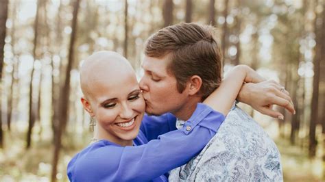 Beauty Shines As Woman Bares Alopecia In Engagement Photos Bbc News