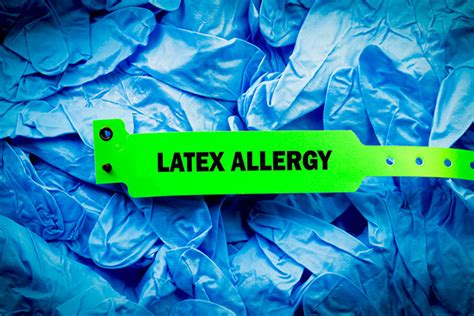 What Does A Latex Glove Allergy Look Like