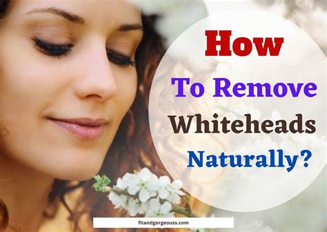 How To Remove Whiteheads Naturally 5 Effective Remedies For You