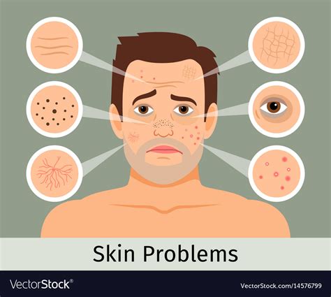 Types Of Skin Problems On Face