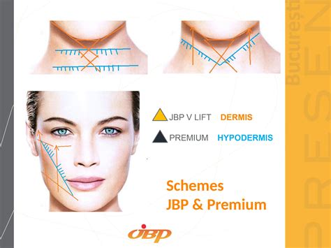 V Lift Pro Non Surgical Facelift Thread Lift Facial Aesthetics