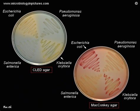 Bacteria On Cled And Mcconkey Agar Escherichia Coli Li