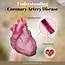 Understanding Coronary Artery Disease CAD  Total Cardiac Care