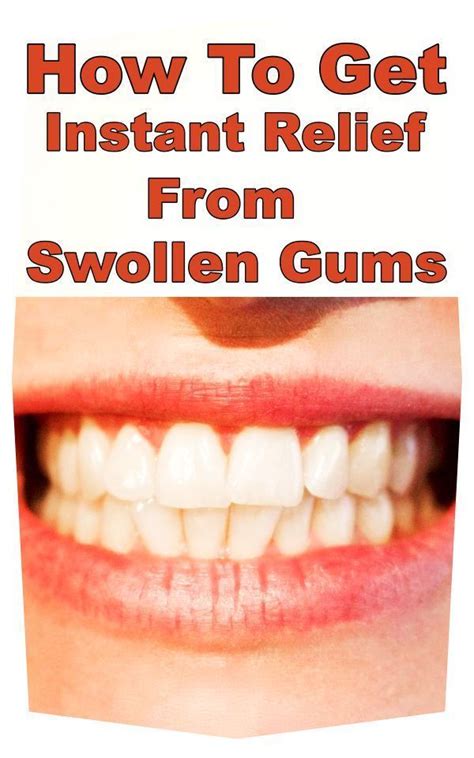 Home Remedies For Swollen Gums For Instant Relief Swollen Gum