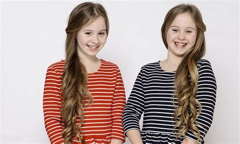Discover The Fascinating World Of Mirror Image Twins