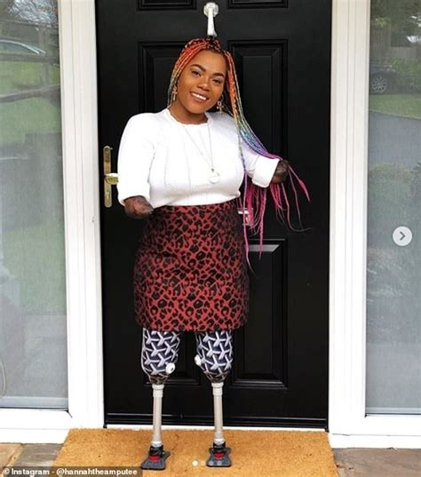 Quadruple Amputee Fashion Influencer Says She Wants To Inspire Others