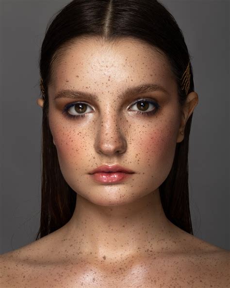 We Love Freckles Photo Contest Winners Viewbug Com