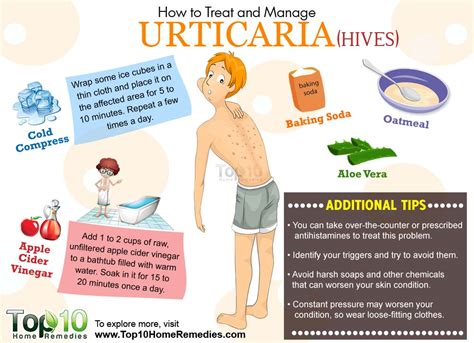 With food allergies, most people react with digestive problems, hives, or breathing problems. How to Treat and Manage Urticaria | Top 10 Home Remedies