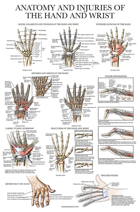 Buy Laminated Anatomy And Injuries Of The Hand And Wrist Hand And