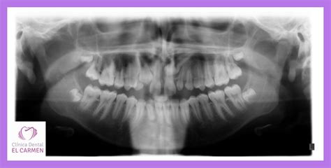 Clínica Dental El Carmen Whatsapp Image 2020 02 01 At 202031