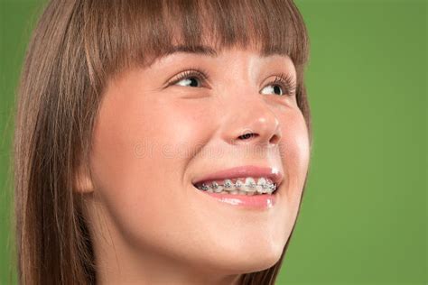 Beautiful Young Woman With Teeth Braces Stock Image Image Of Individual Girl 124420035