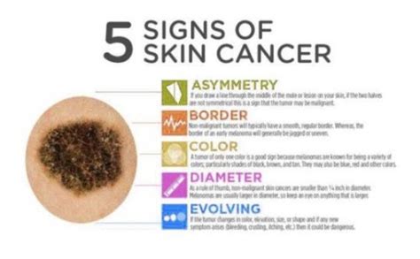 Body As Doctor Skin Cancer Facts And Stats