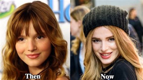 Bella Thorne Plastic Surgery Before And After Photos