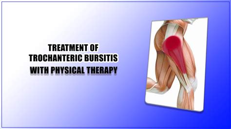 Expert Guide About The Treatment Of Trochanteric Bursitis With Physical