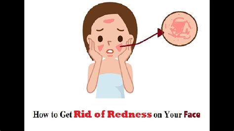 How To Get Rid Of Redness On Your Face Youtube