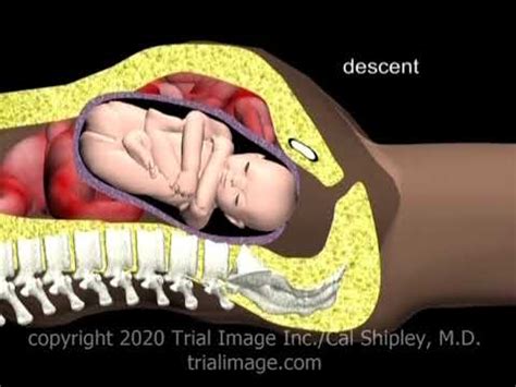 Normal Vaginal Delivery Movement Through The Birth Canal Animation By