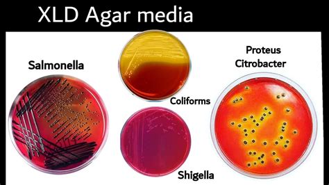 Xld Agar Xylose Lysine Deoxycholate Agar Microbiology Youtube
